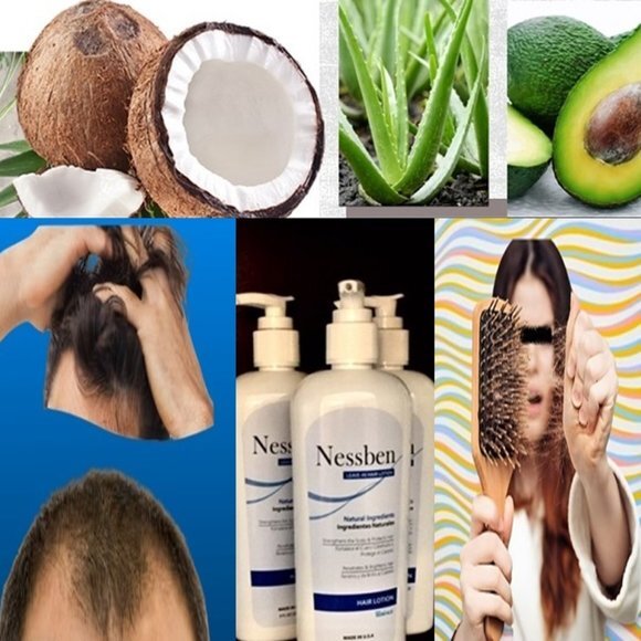 USA Unisex Extra Strength Hair Natural Lotion 1 bottle 8 oz supply x 1 month‎ - Picture 2 of 9